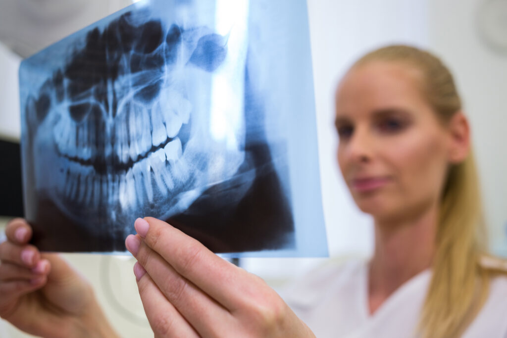 The Truth About Dental X-Rays and Safety What Harrisburg, PA Patients Should Know at Nova Dental